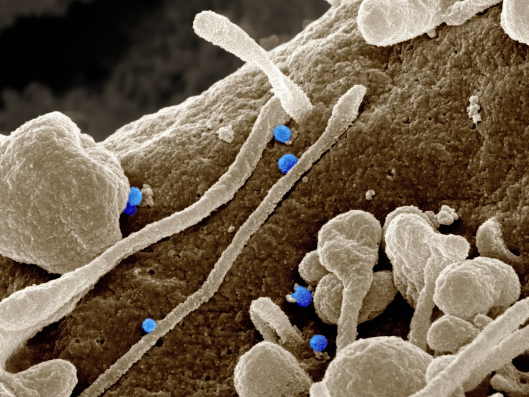 Co oznacza podwyższony poziom kwasu moczowego - diagnostyka i objawy
