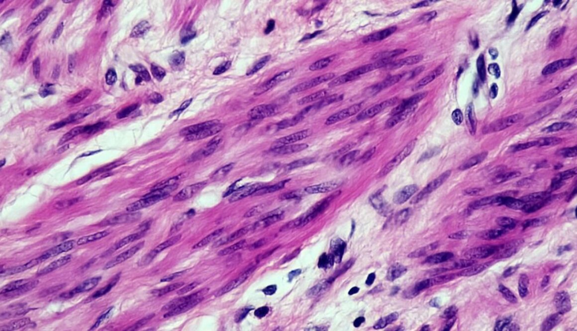 Markery nowotworowe a badanie krwi - kiedy i jak je interpretować